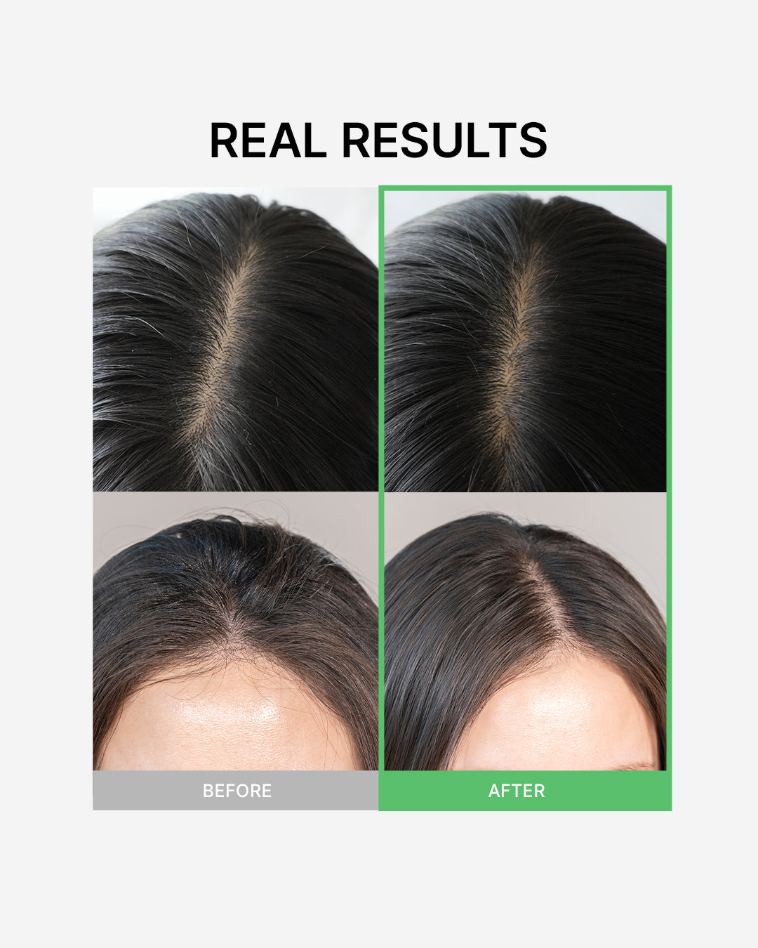 Tea Tree Calming Dry Shampoo 100ml