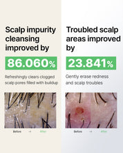 Tea Tree Calming Scalp Shampoo 330ml