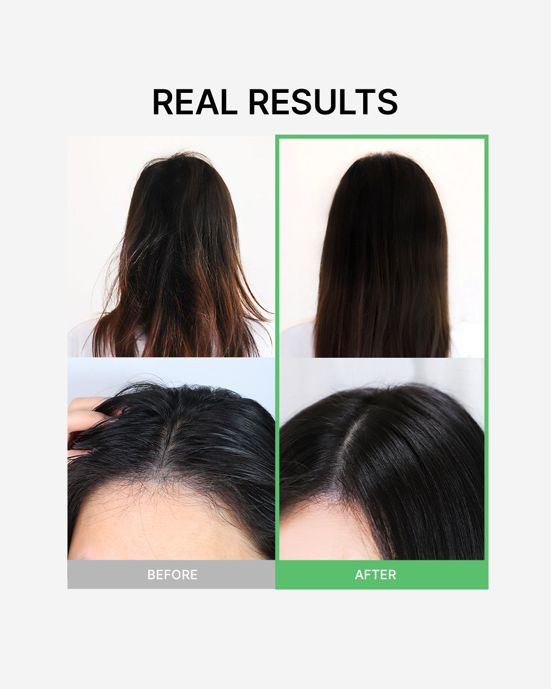 Tea Tree Calming Scalp Treatment 330ml